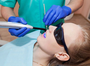 Dental Filling