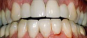 Combination Treatments 3