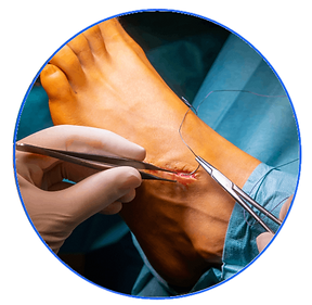 a surgeon sutures a wound on a foot with needle holder and thread