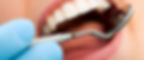 Dental exam