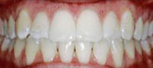 Orthodontics 1