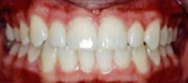 Orthodontics 9