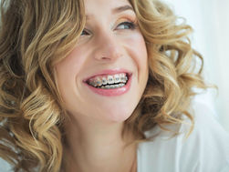 5 Tips to Avoid Teeth Stains from Braces