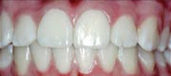 Orthodontics 4