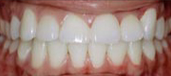 Orthodontics 18