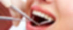 Dental exam