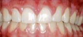 Orthodontics 13