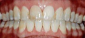 Orthodontics 6