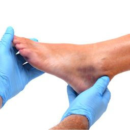 Swollen foot