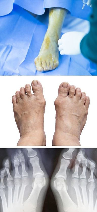 foot clinic