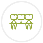 Dental Bridges