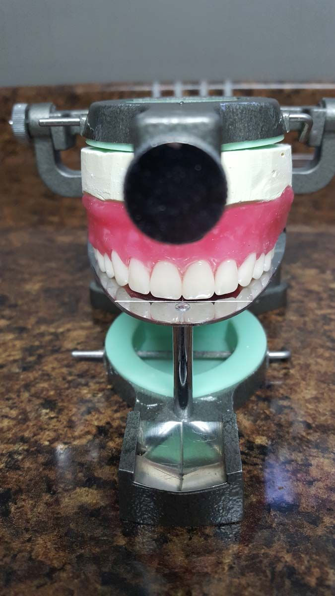 support tool for dentures