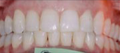 Orthodontics 5