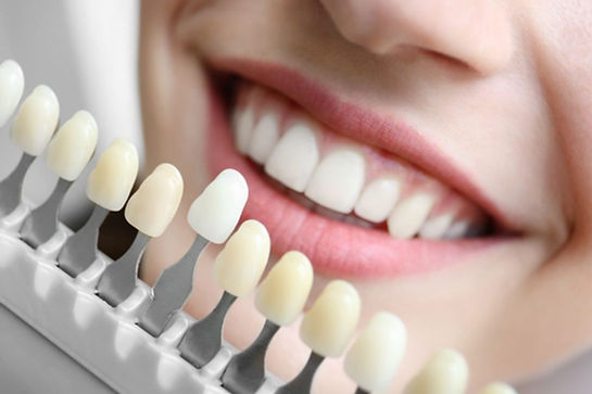 smiling lady holding dental implants