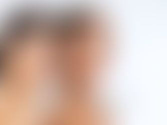 Experience the Power of a HydraFacial for Your Skin Condition