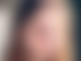 What is the best wrinkle reducer treatment?