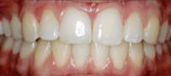 Orthodontics 16
