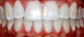 Orthodontics 10