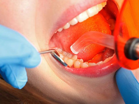 HOW TO MAKE DENTAL FILLINGS LAST LONGER