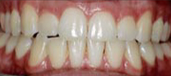 Orthodontics 15