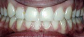 Orthodontics 14