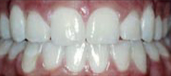 Orthodontics 8