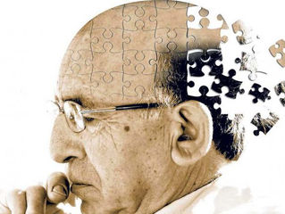 Fisioterapia e a Doença de ALZHEIMER