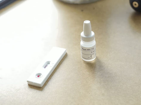 Invita Salud Pública a realizarse pruebas rápidas de VIH de manera gratuita