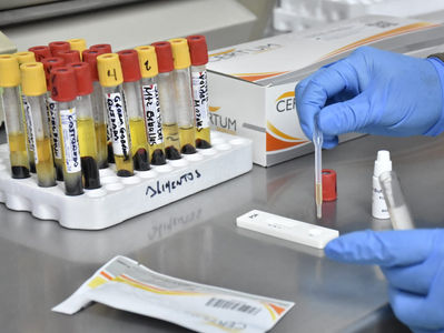 Salud Municipal de Gómez Palacio continúa realizando pruebas para detectar el cáncer de próstata