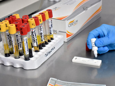 Salud Municipal da seguimiento a pruebas de cáncer de próstata