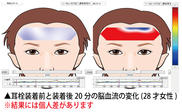 サムネイル： ミミケア