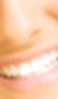 Big Smile