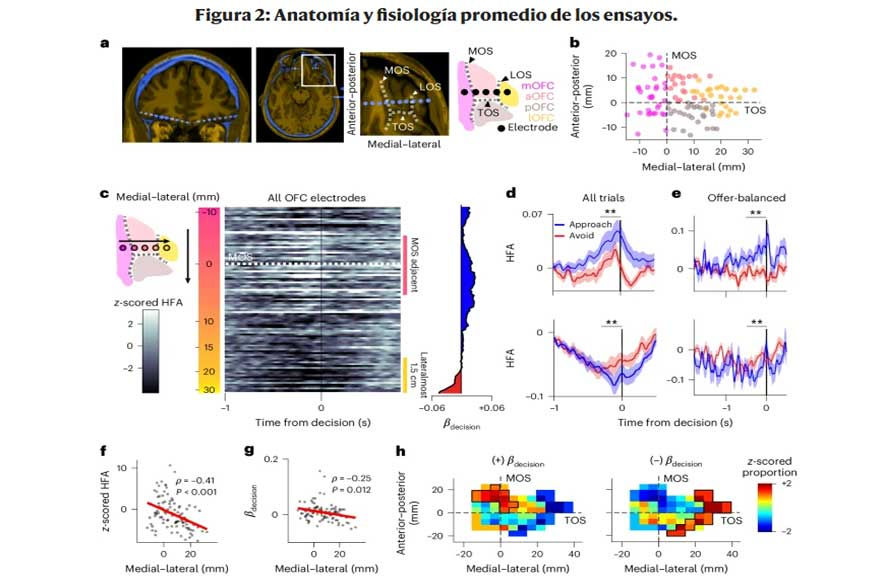 Neuroinvestigadores saben lo que hará una persona antes que ella misma. Centro de Psicología Aplicada Maribel Gámez
