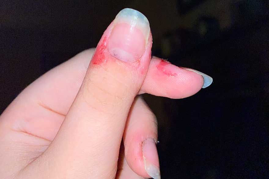 Dolor que alivia. Qué son y cómo manejar las autolesiones en los jóvenes. Centro de Psicología Aplicada Maribel Gámez