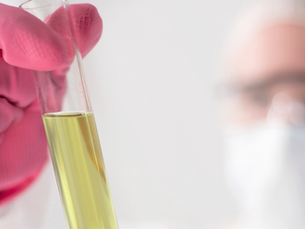 Sjukvårdspersonal som håller i ett rör med urinprov.