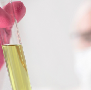 Sjukvårdspersonal som håller i ett rör med urinprov. 