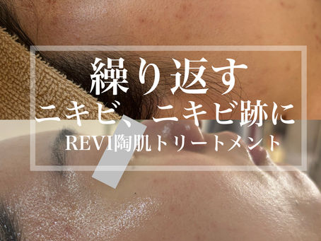 繰り返すニキビ、ニキビ跡にハーブピーリング！