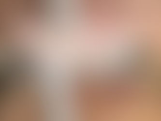 ララピール1年間続けたお肌