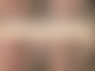 繰り返す肌荒れにもハーブピーリング！