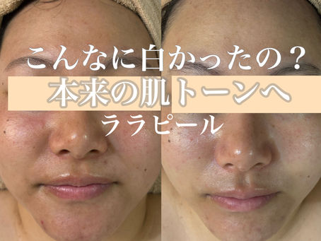 肌は意外とくすんでます！