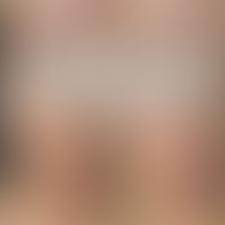 肌質改善は3ヶ月〜