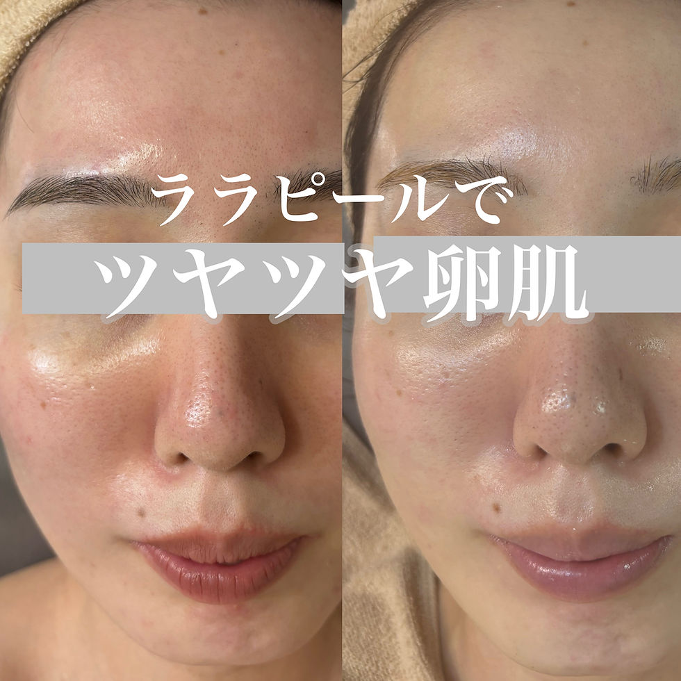 ララピールでツヤツヤ肌！