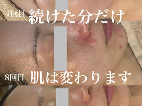 頑張っ分お肌は変わります！