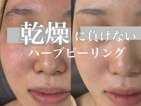 乾燥に負けない肌に！