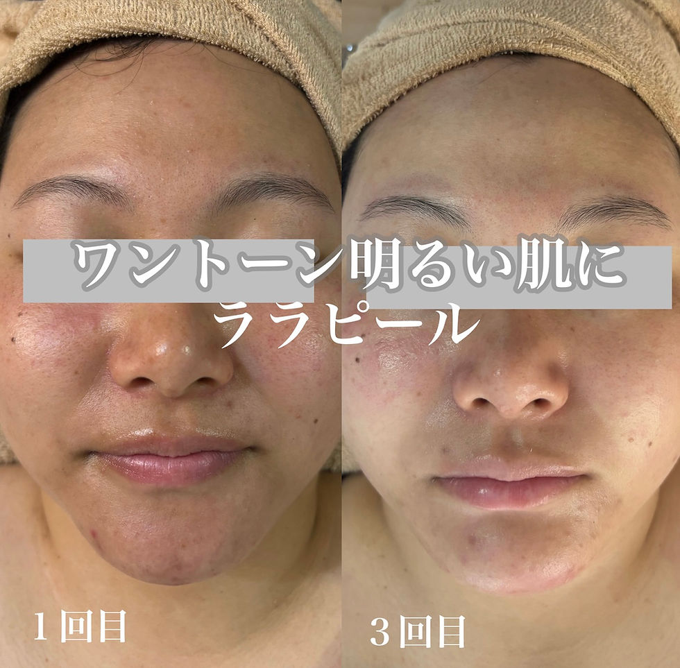 ララピールでワントーン明るい肌に!