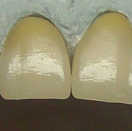 Dentadura caracterizada