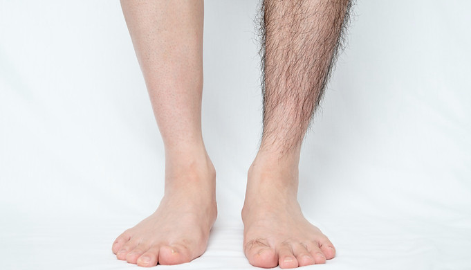 TBTG-HAIR REMOVAL R4.jpg