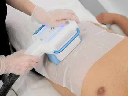 How CoolSculpting and Fat Freezing can help you lose weight