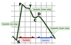pwv1.gif