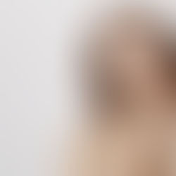 Quenching Your Curiosity: FAQs about IV Hydration Answered